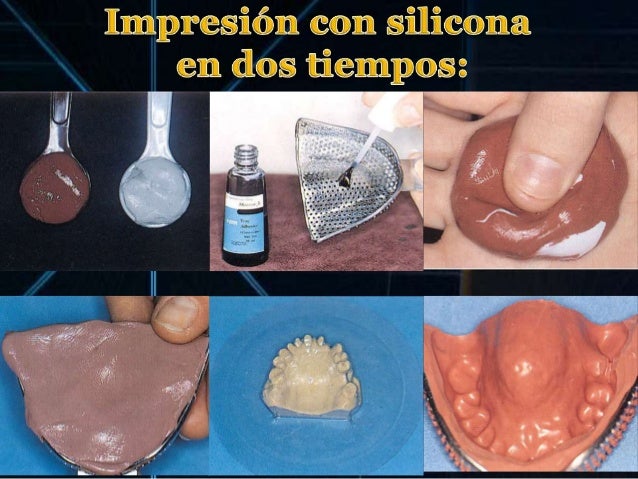 IMPRESIONES EN PROTESIS FIJA