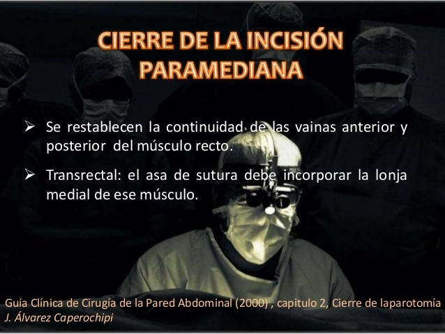 Angiohirurg o flebolog en que la diferencia
