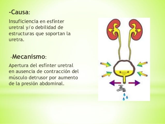 Duele la espalda como dormir