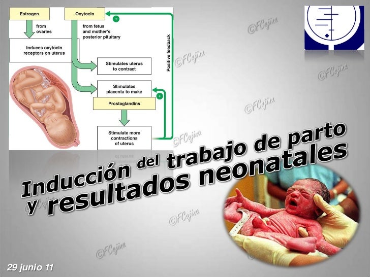 INDUCCION TRABAJO PARTO induccion trabajo parto:
