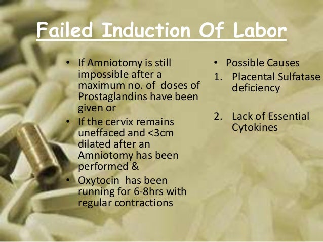 Induction Of Labour induction-of-labour