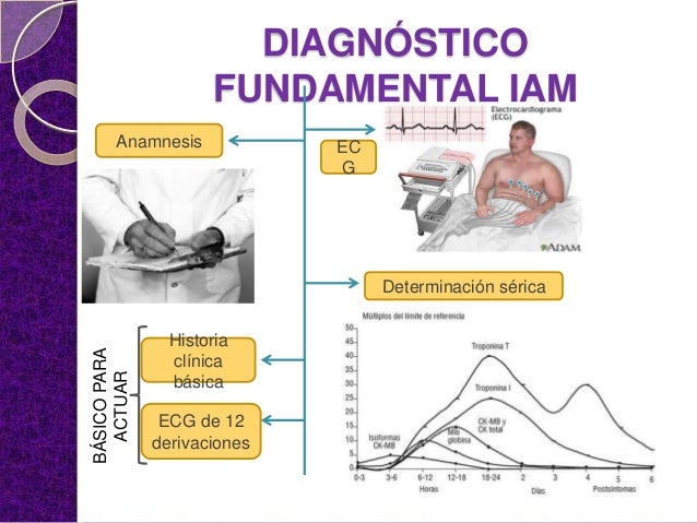 Diagnostico Nanda Para Infarto Agudo Al Miocardio es.slideshare.net