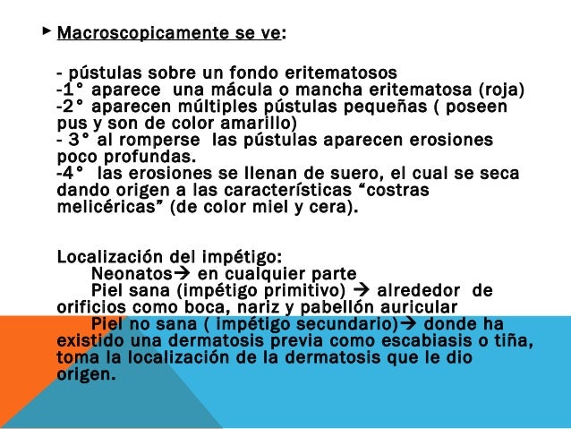 Las causas metafísicas las manchas de pigmento