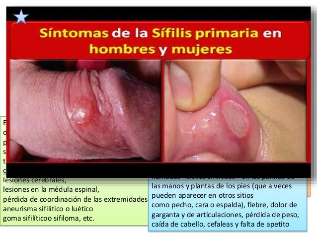 El medio contra el hongo para de baño