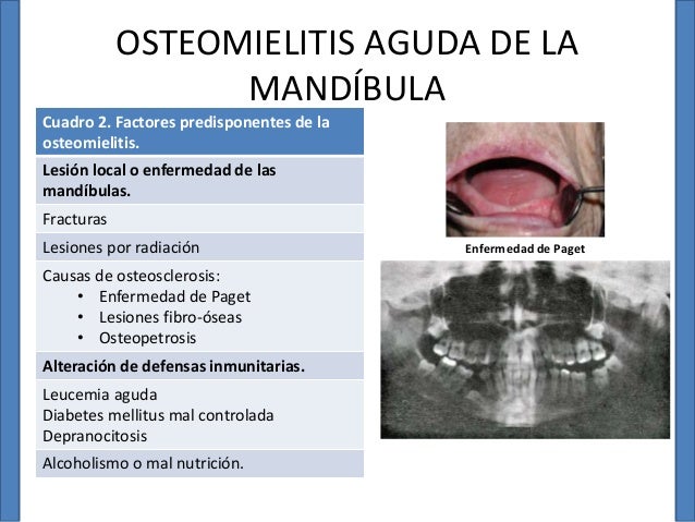 La codificación del alcohol la esfera de Chelyabinsk