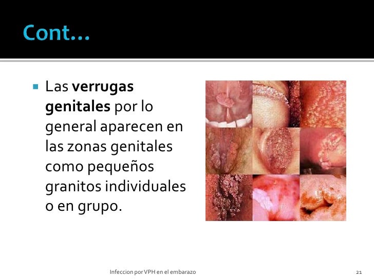La tintura para el aumento del miembro viril