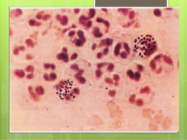 Accutane online