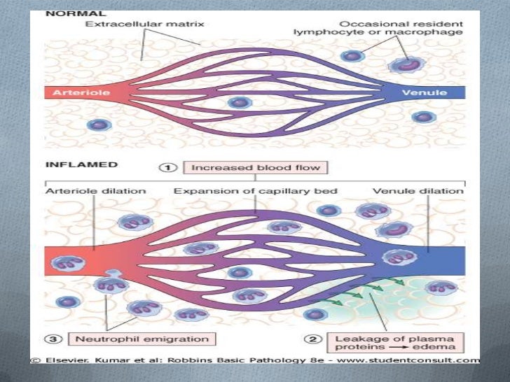 Inflamacion aguda y crónica