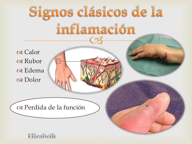 Inflamacion- Patologia Basica