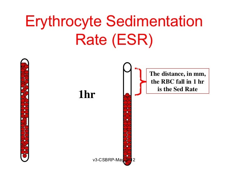 What is a normal sedimentation rate?