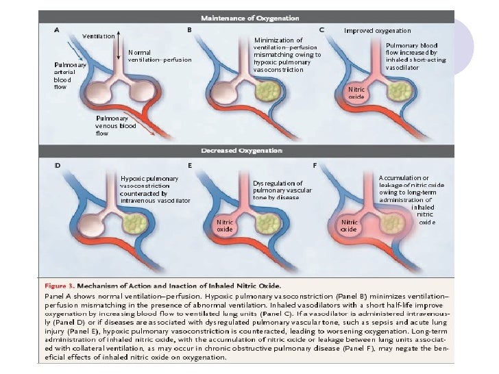 Inhaled nitric oxide therapy in adults