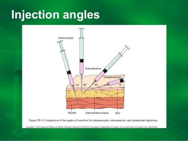 injection-presentation