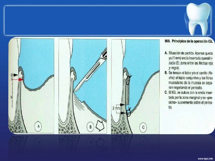 Sobre que maqueta de entrenamiento es posible adelgazar más rápidamente