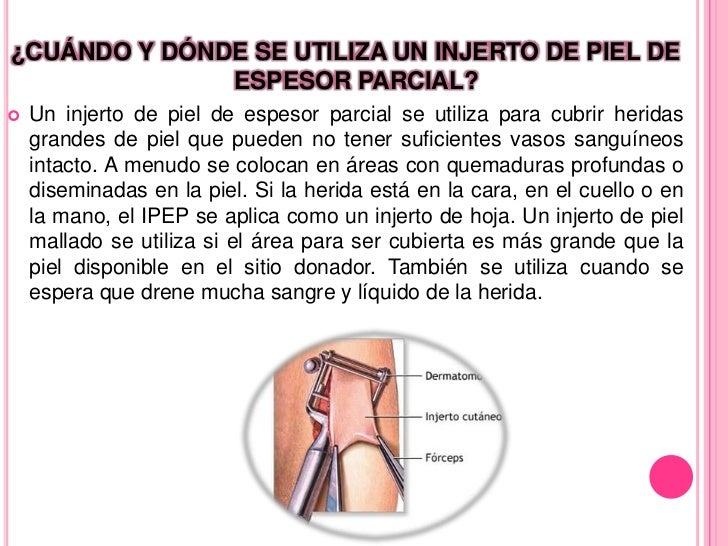 Por qué duele el departamento de pecho de la columna vertebral solamente por la noche