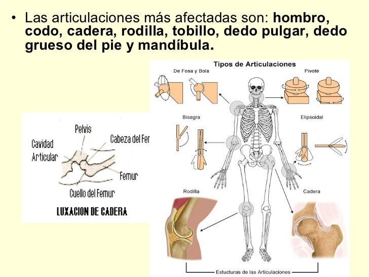 El ungüento del hongo en los pies zalain el precio