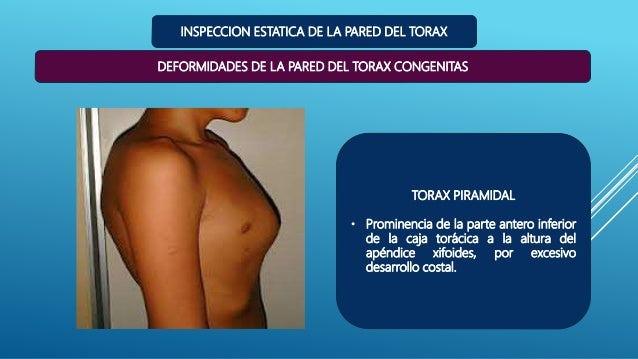 De la víctima de las operaciones plásticas al pecho
