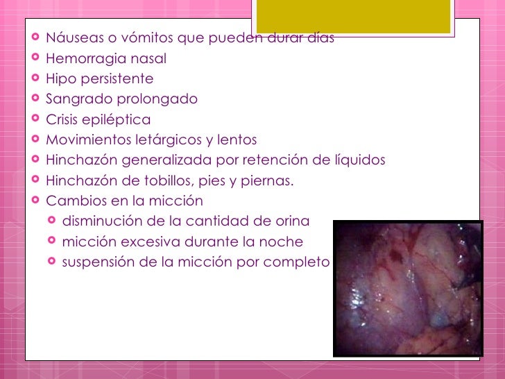 El complejo completo a sheynom la osteocondrosis del vídeo