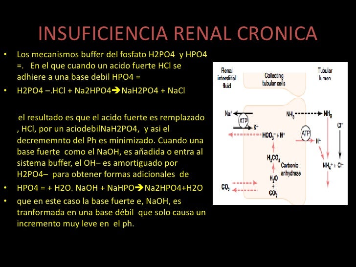 Insuficiencia renal cronica pediatria Insuficiencia renal cronica pediatria