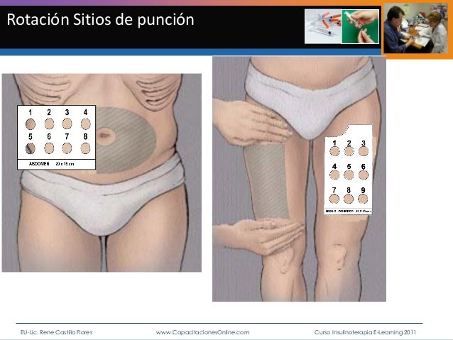 Insulina y enfermería. curso e learning insulinoterapia Insulina y enfermería. curso e learning insulinoterapia