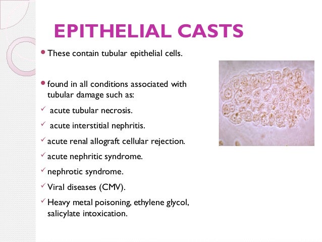 Epithelial Cells in Urine: Types, Test Results, Causes