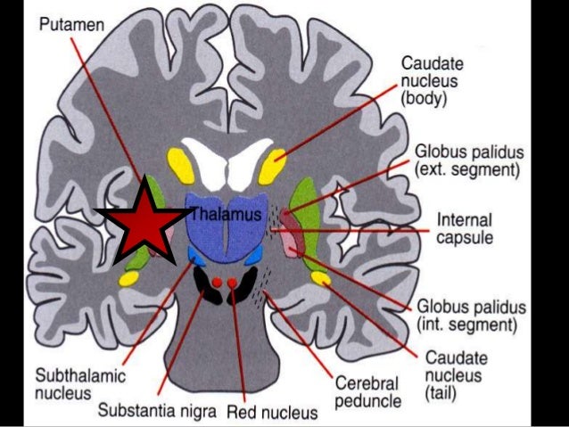 What is textual content with stroke treatment of mild stroke