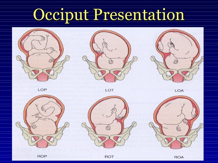 Intrapartum Care and Abnormal Labor