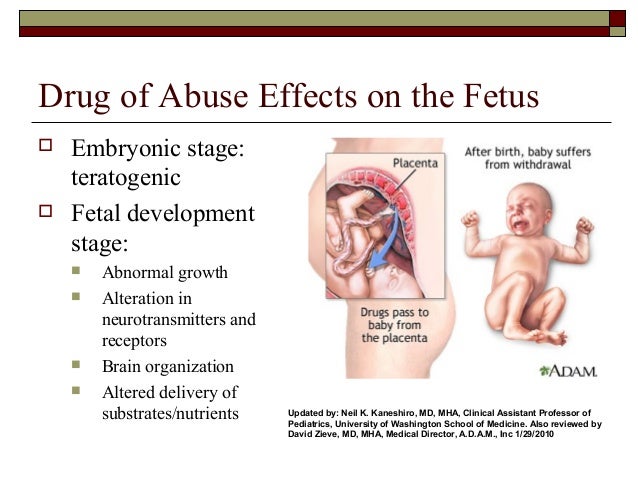 the effects of alcohol abuse on developing fetal alcohol syndrome the effects of alcohol abuse on developing fetal alcohol syndrome