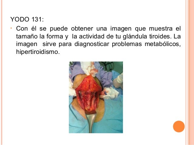 World health organization ivermectin