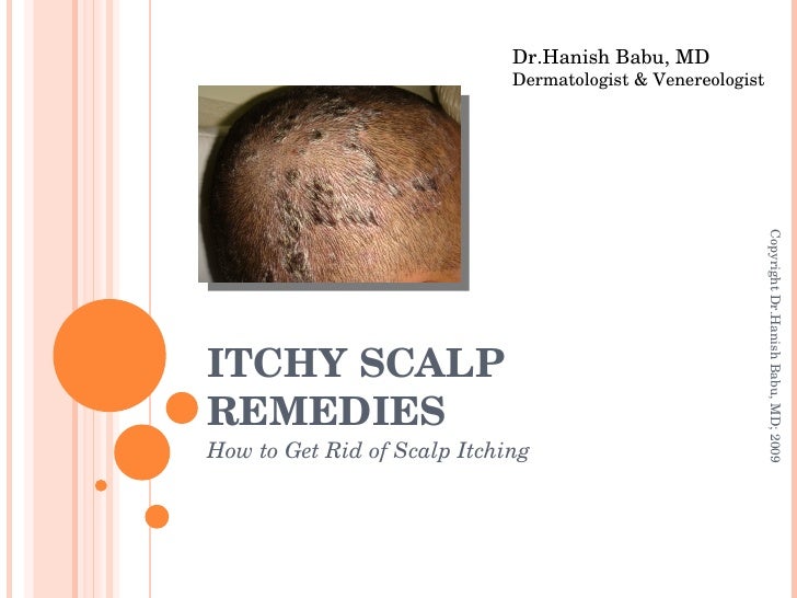 itchy home remedy itchy scalp remedies itchy home remedy itchy scalp remedies