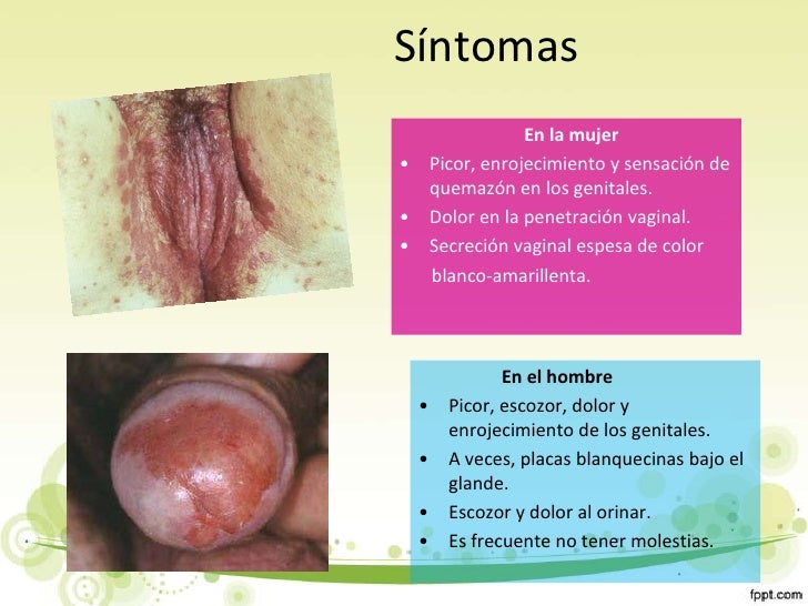 Los miembros gigantescos en pequeño piske