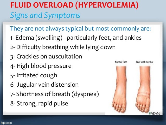 SEARCH AND BUY THIS PRODUCT Iv fluid therapy (types, indications, doses calculation)