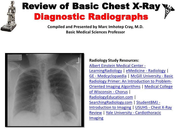IVMSReview of Basic Chest XRay and Diagnostic Radiography