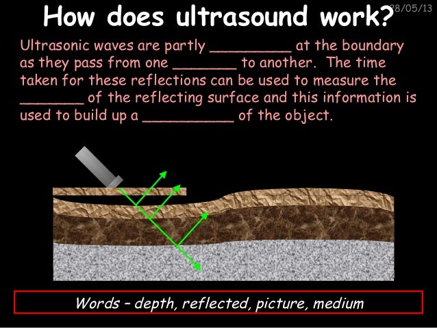 how do dating ultrasounds work Ultrasound technicians usually work in clinics that specialize in a particular type of treatment if becoming an ultrasound tech is your primary career goal. how do dating ultrasounds work Ultrasound technicians usually work in clinics that specialize in a particular type of treatment if becoming an ultrasound tech is your primary career goal.