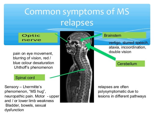 2019 year - When MS Attacks the Spinal Cord 2019 year
