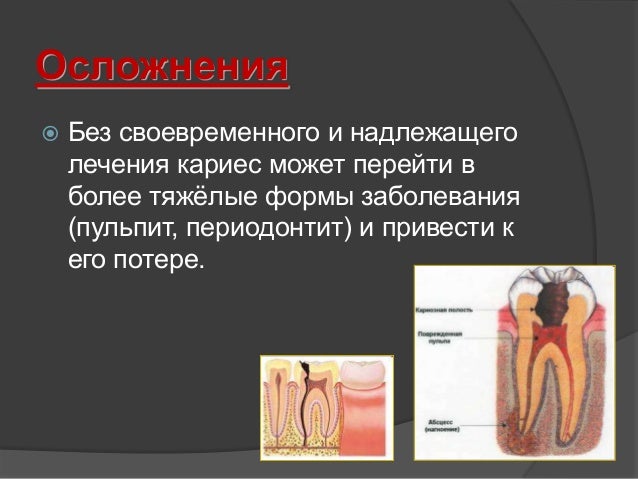 Лечение болезнь суставы