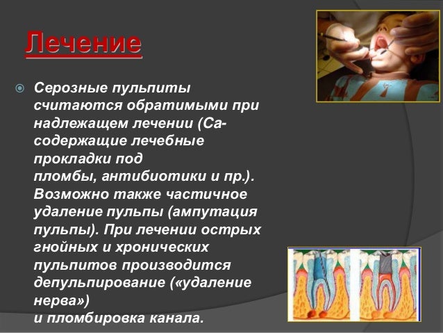 Боли внизу живота и белесые выделения