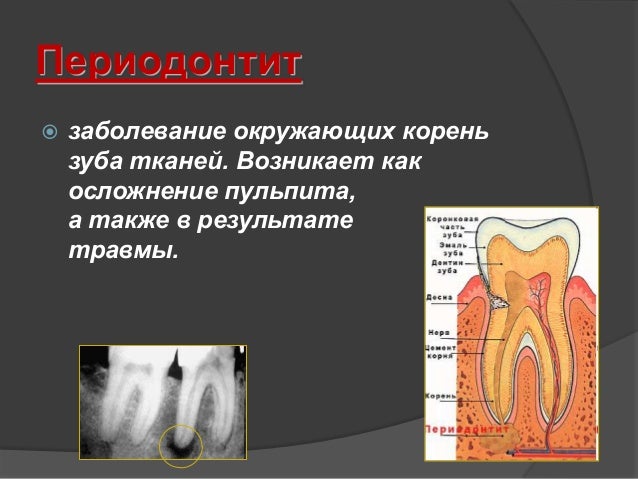 Почему боли ночью в ноге сильнее