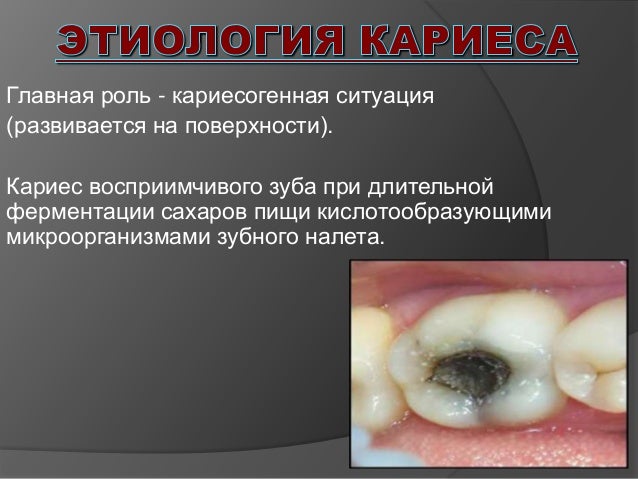 Мятная жевательная резинка при боли в горле