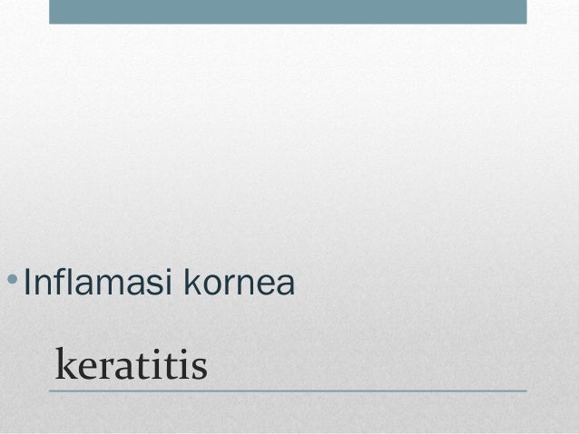 Asprnn hakkinda blnenler Eyeportal