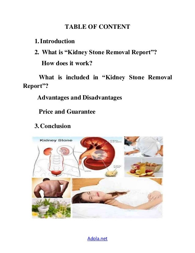 kidney stone removal report review what is the best kidney stone size chart