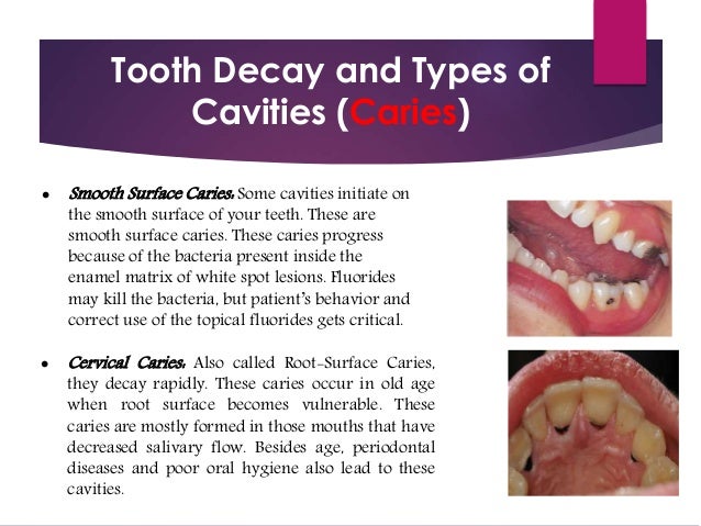 Do You Know the Different Types of UC Do You Know the Different Types of UC