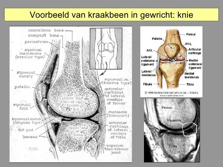 zwevend kraakbeen knie