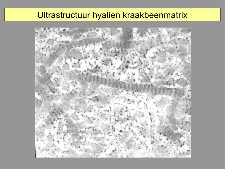hyalien kraakbeen
