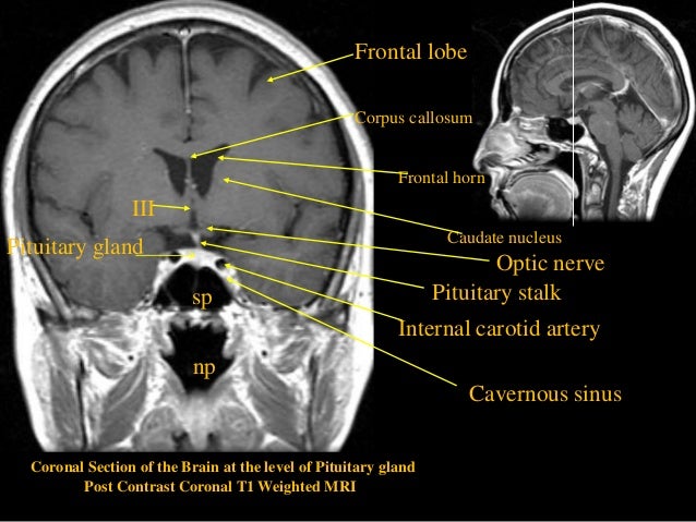 Ct scan iv trading system