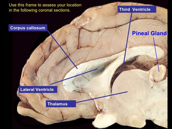 Lab 14 Sheepbraindiss 2