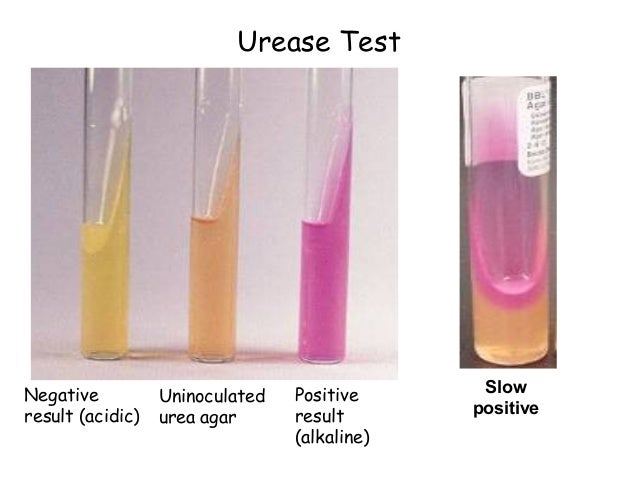 microbiology differential tests mind42 urease test