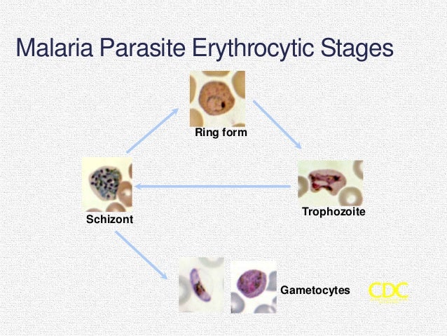 Malaria Multiple Ring Forms Malaria Multiple Ring Forms