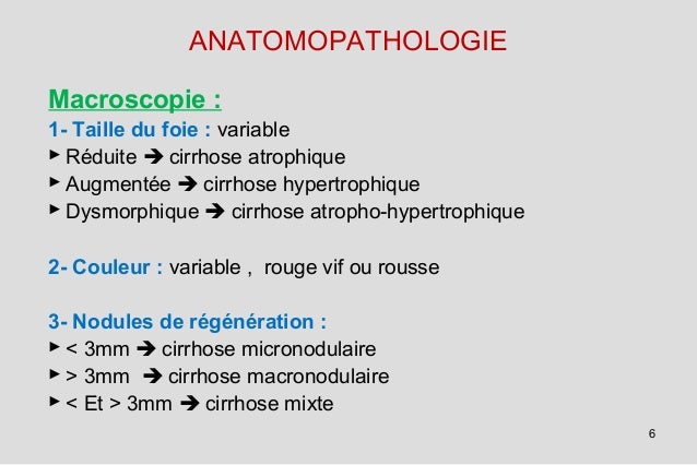 Carcinome Hepatique