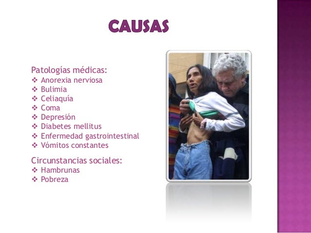 La desnutricion - Cuadro clinico - sintomas y causas La desnutricion - Cuadro clinico - sintomas y causas