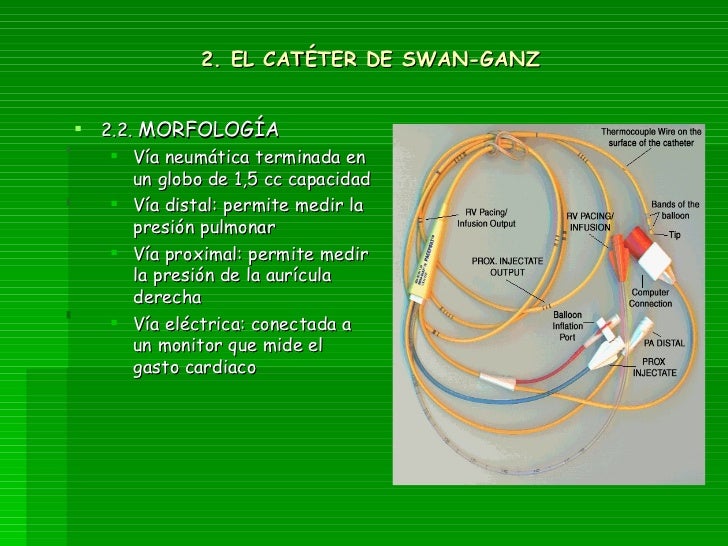 La implantación del catéter swan ganz por vía antecubital